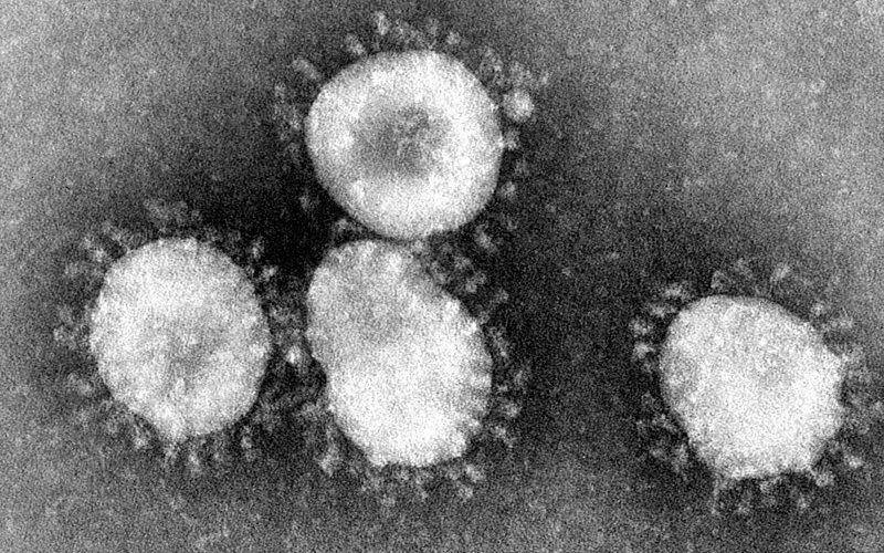 How Coronavirus is Affecting Business Worldwide